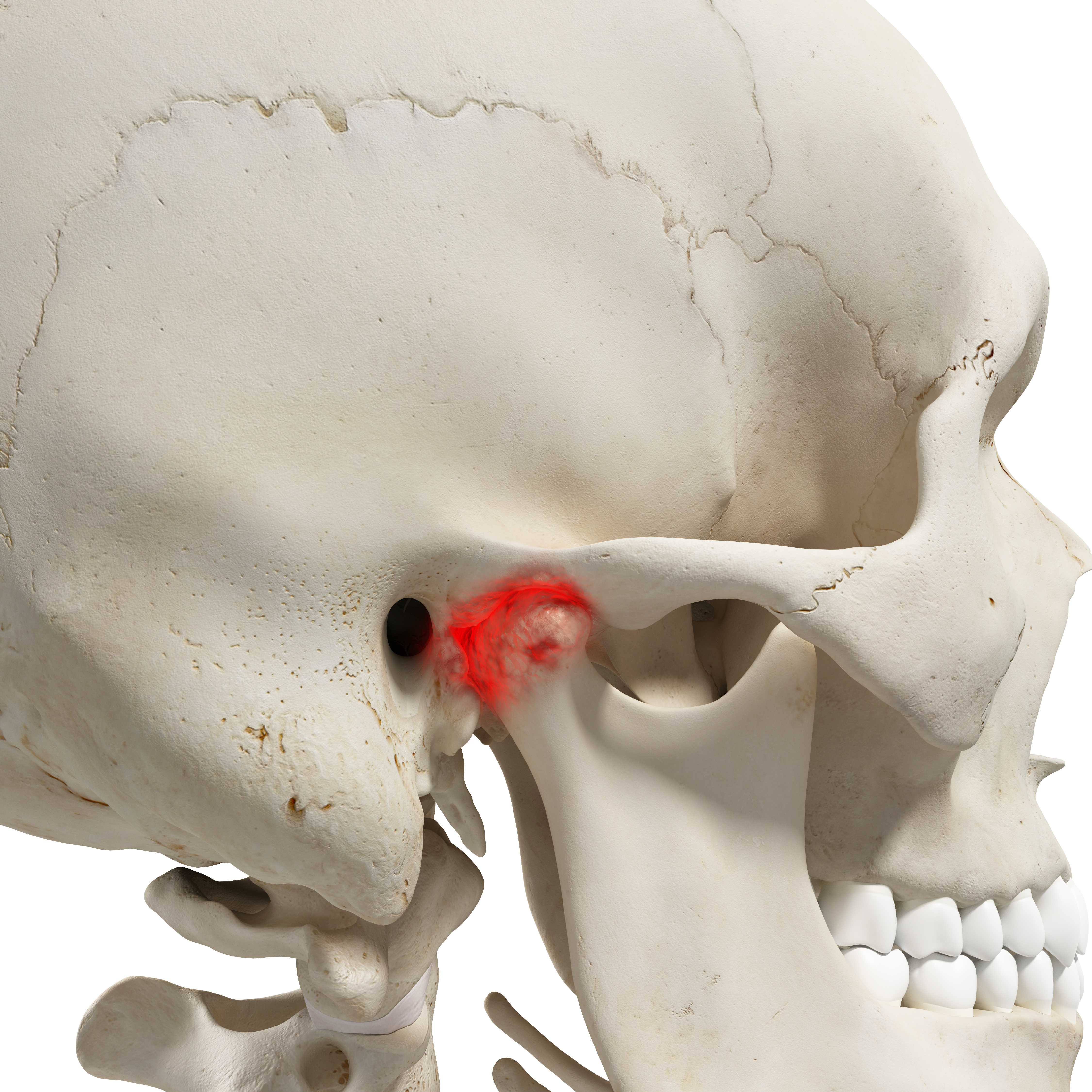 Physiotherapeutische Untersuchung und Behandlung des Kiefergelenks